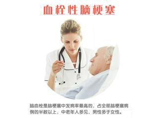 血栓性脑梗塞