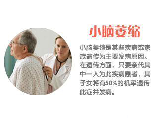 小脑萎缩
